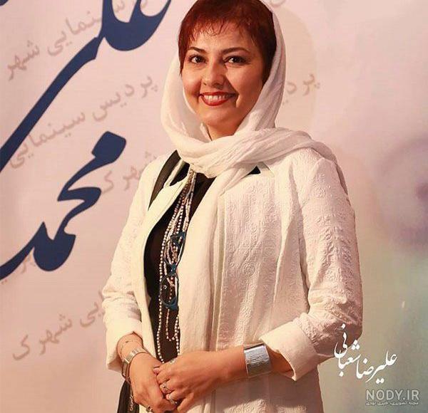 عکس متین ستوده قبل از عمل