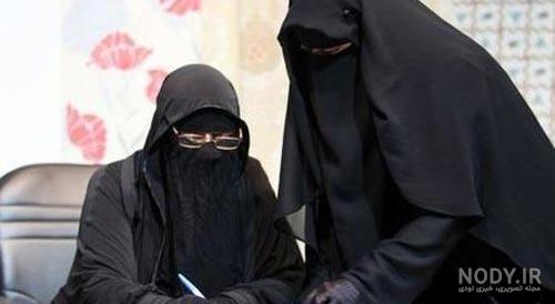 عکس چشم گریون طبیعی