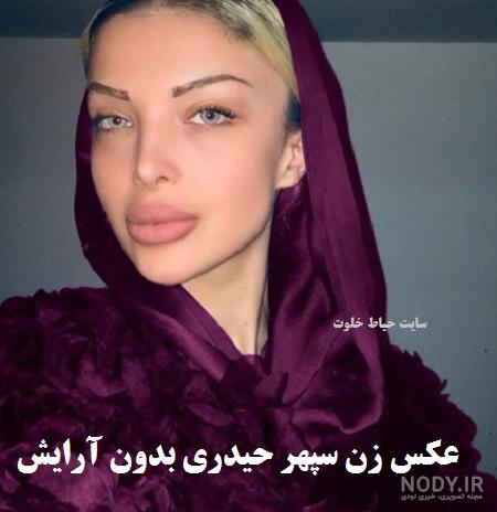 همسر سپهر حیدری قبل عمل همسر سپهر حیدری قبل عمل