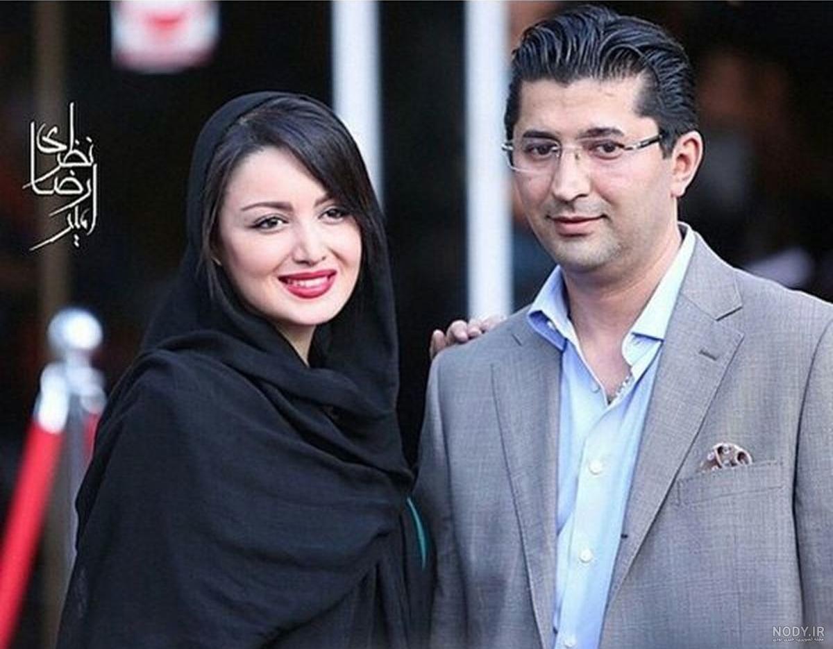همسر شیلا خداداد جراح بینی همسر شیلا خداداد جراح بینی
