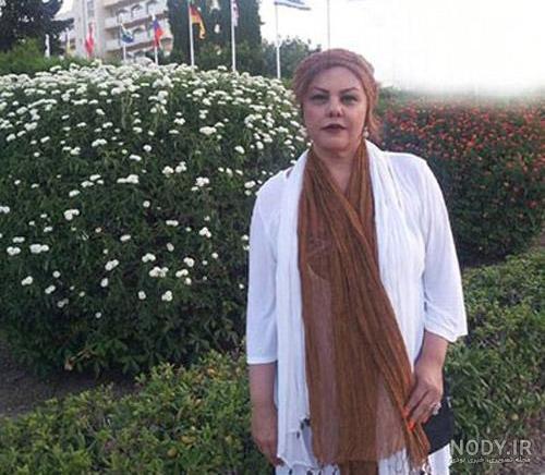 افسانه چهره آزاد قبل از عمل