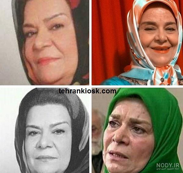 زهرا اویسی قبل از عمل زیبایی زهرا اویسی قبل از عمل زیبایی