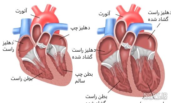 علائم سکته قلبی در گربه