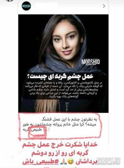 عکس عمل چشم ترلان پروانه