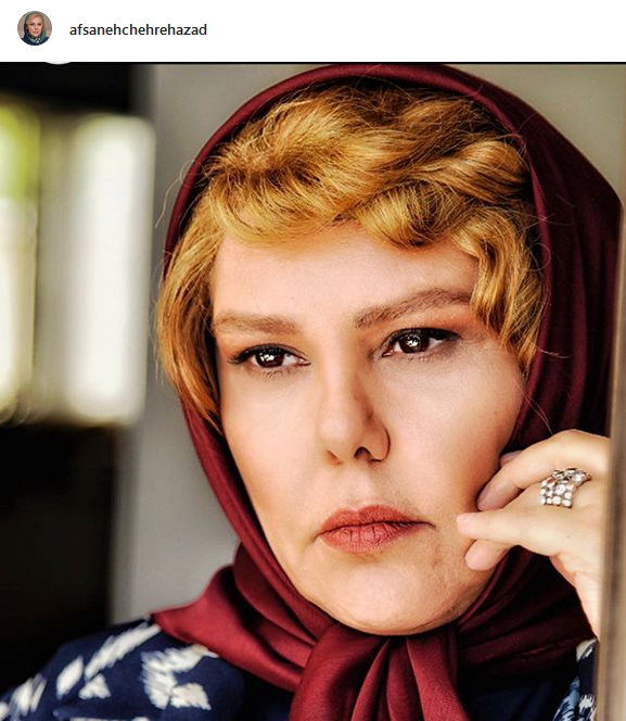 عکس افسانه چهره آزاد قبل از عمل عکس افسانه چهره آزاد قبل از عمل