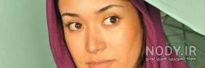 عکس بهاره افشاری قبل از عمل زیبایی عکس بهاره افشاری قبل از عمل زیبایی