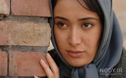 عکس بهاره افشاری قبل عمل عکس بهاره افشاری قبل عمل