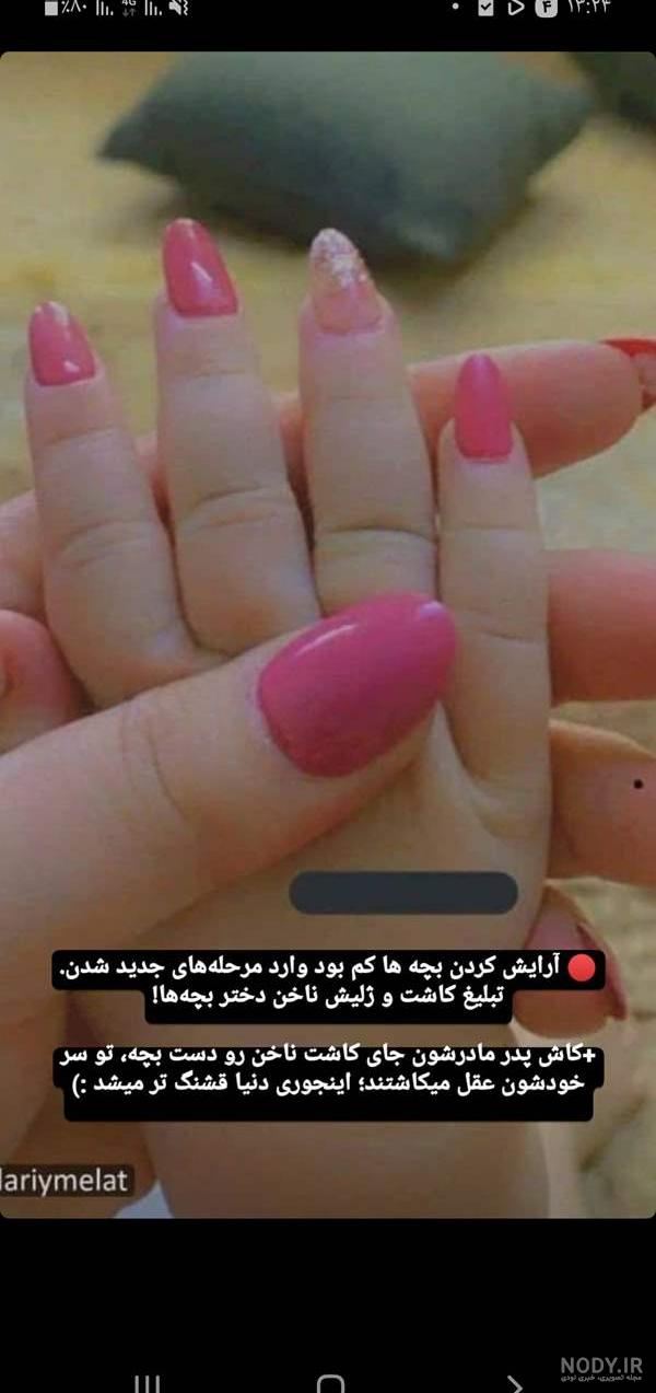 مطلب در مورد کاشت ناخن مطلب در مورد کاشت ناخن