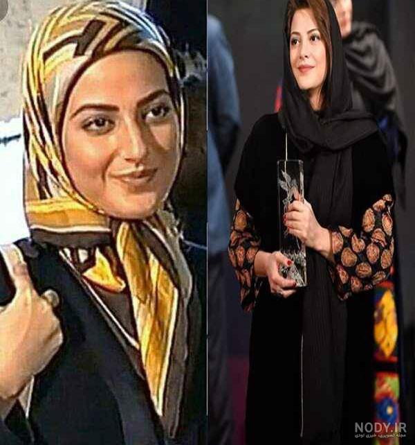 بهنوش طباطبایی قبل از عمل چشم