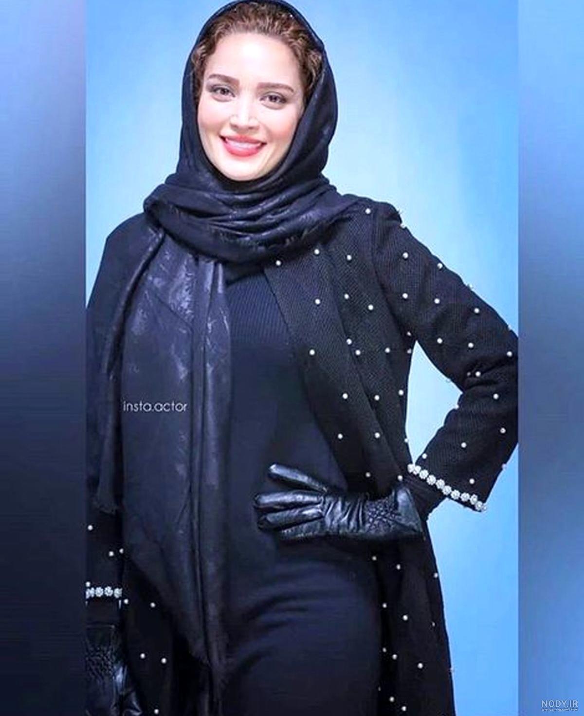 بهنوش طباطبایی چه عمل زیبایی انجام داده