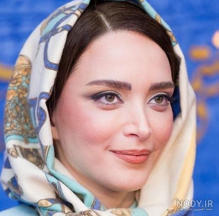 طناز طباطبایی قبل از عمل