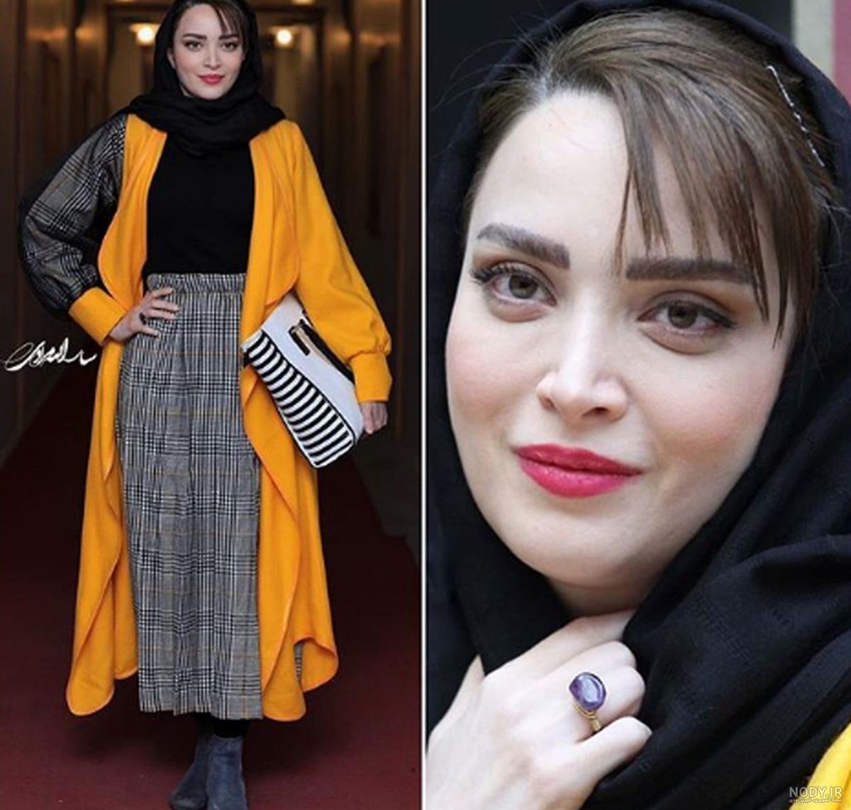 علت تغییر چهره بهنوش طباطبایی