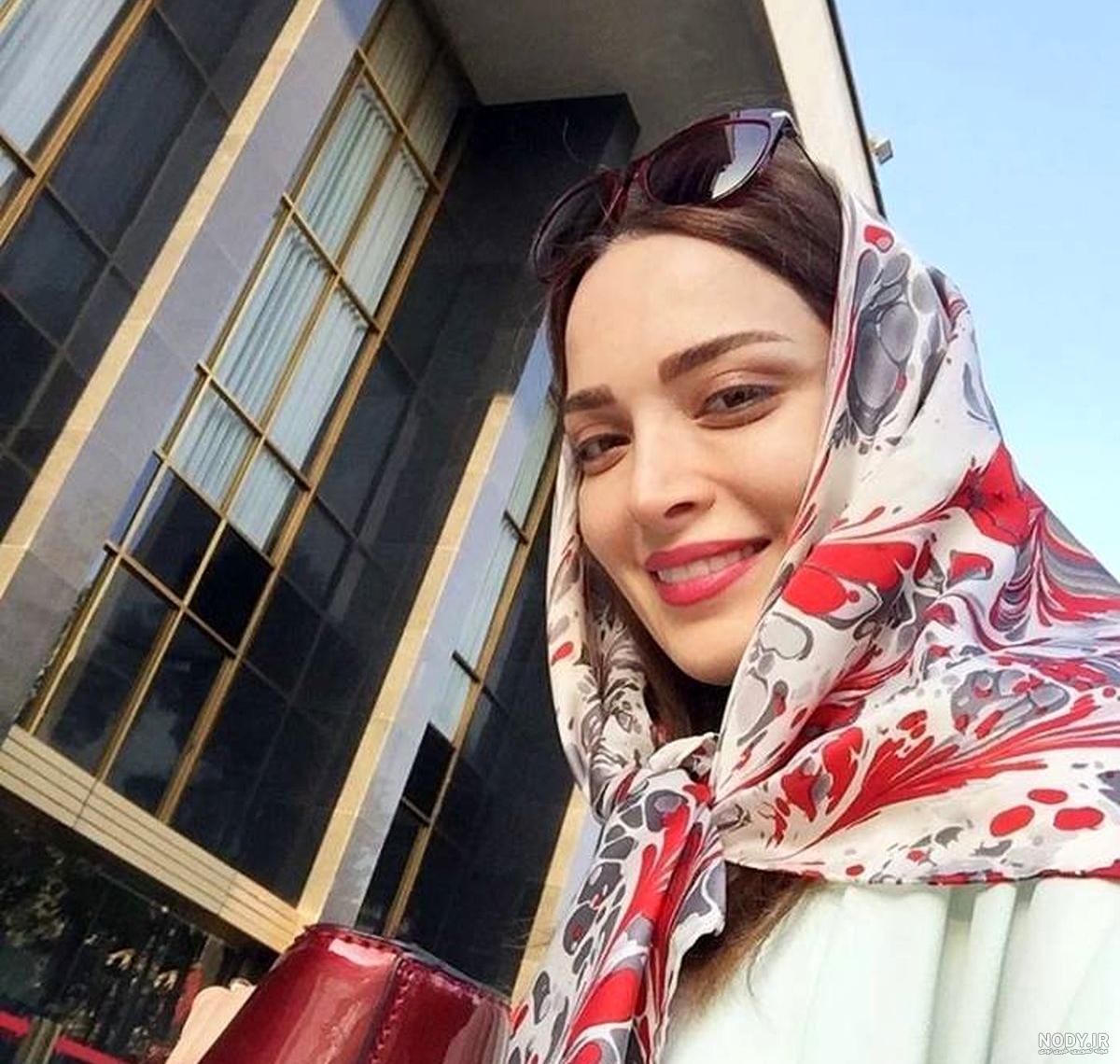 علت تغییر چهره بهنوش طباطبایی