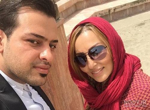 عکس بازیگران مرد ایرانی قبل و بعد از عمل زیبایی