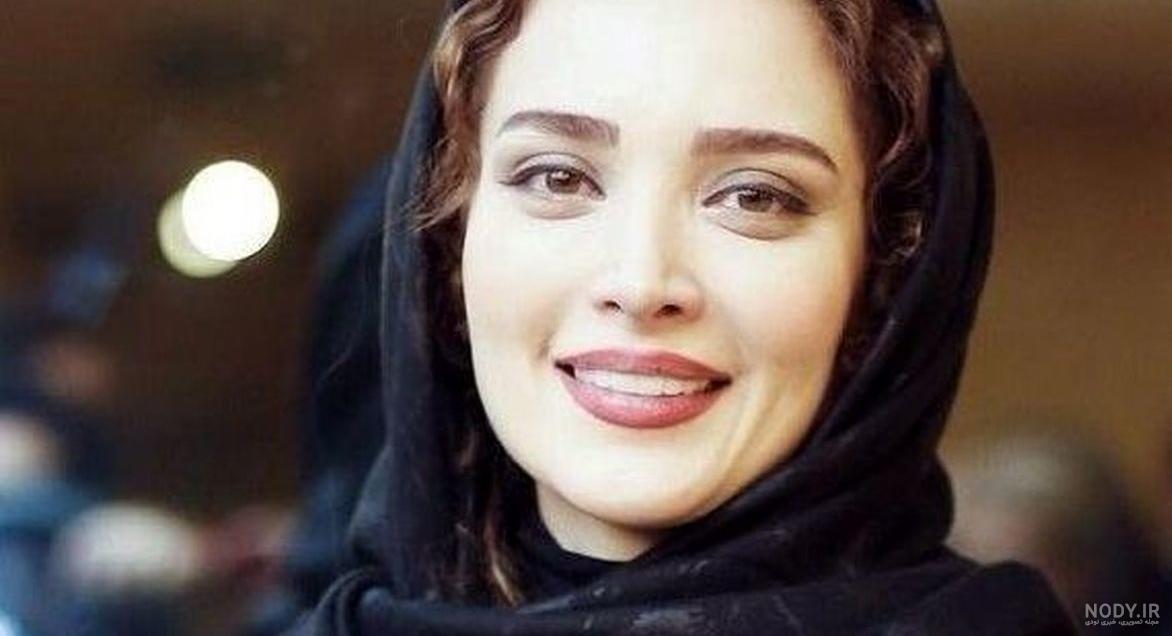 عکس بهنوش طباطبایی بعد از عمل بینی