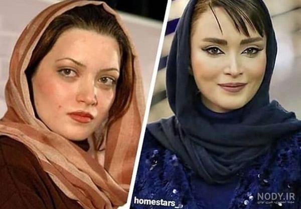 عکس بهنوش طباطبایی قبل از عمل بینی