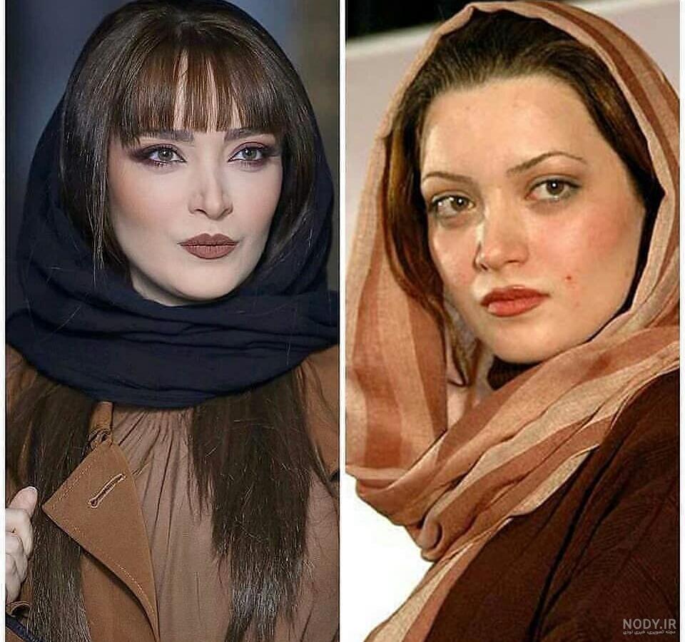 عکس بهنوش طباطبایی قبل از عمل بینی