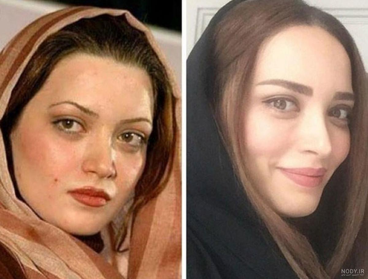 عکس بهنوش طباطبایی قبل از عمل زیبایی