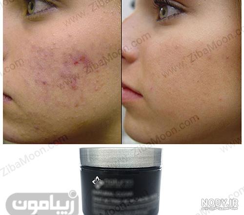 ماسک خاک رس و گلیسیرین ماسک خاک رس و گلیسیرین