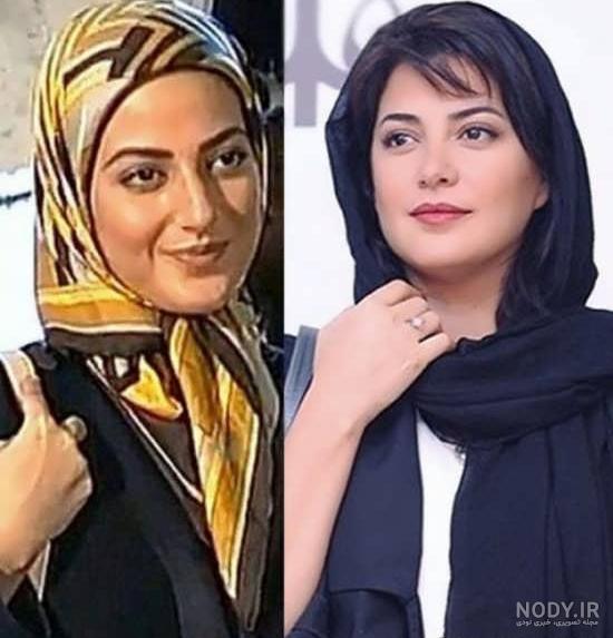 نام جراح بینی بازیگران معروف