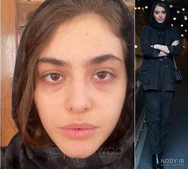 اعضای بلک پینک قبل از عمل اعضای بلک پینک قبل از عمل