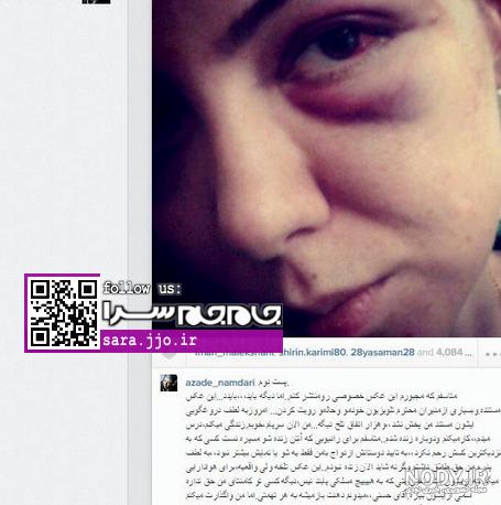 عکس العمل فرزاد حسنی به درگذشت آزاده نامداری