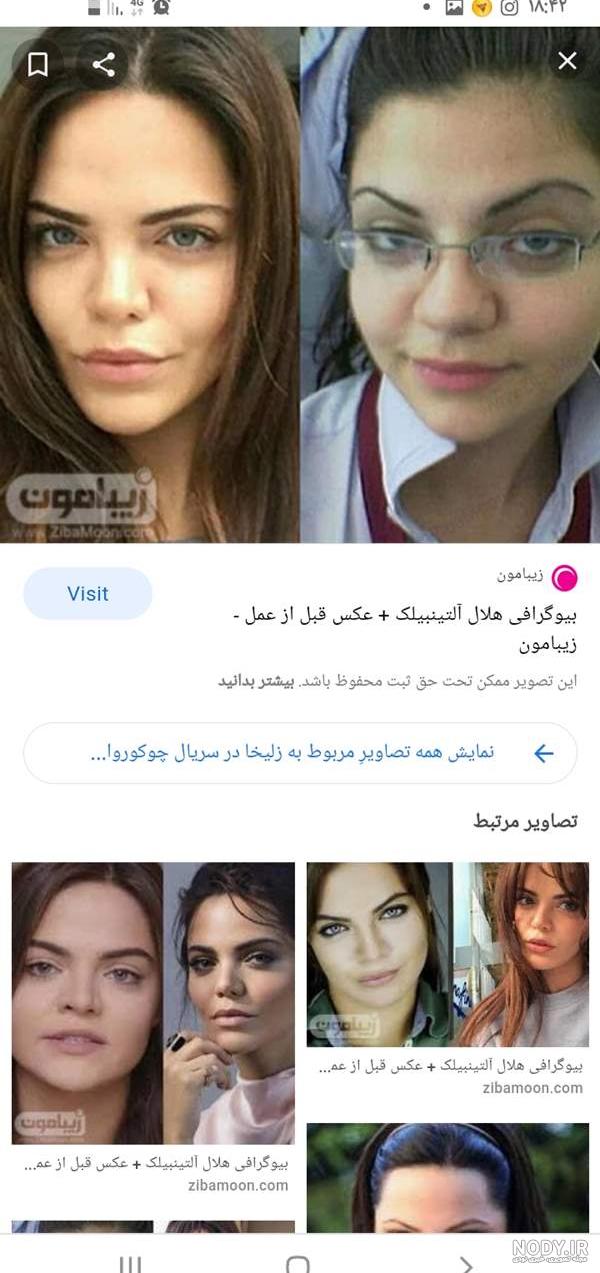 عکس زلیخا در فیلم چوکوروا قبل از عمل