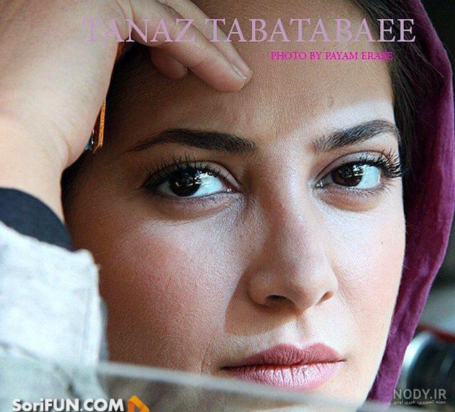 عکس طناز طباطبایی قبل از عمل عکس طناز طباطبایی قبل از عمل