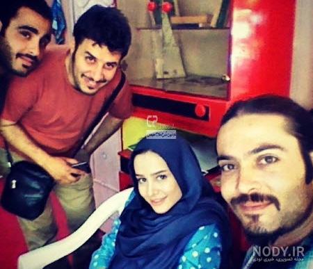 الناز حبیبی قبل از عمل