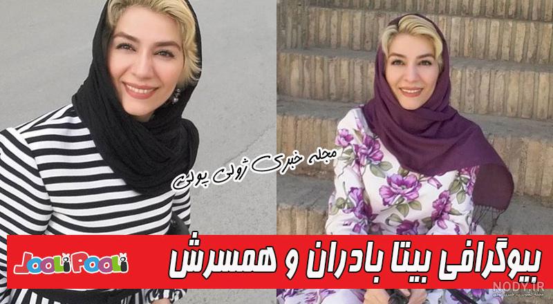 بیتا بادران قبل از عمل بیتا بادران قبل از عمل