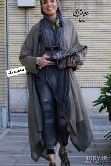 سامیه لک قبل از عمل سامیه لک قبل از عمل