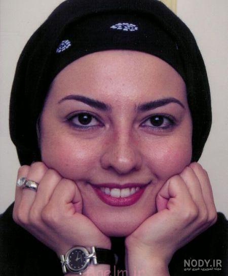جراح بینی آنا نعمتی کیست