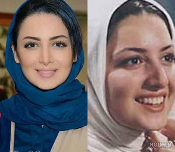 دکتر شاهرخ فرزام پور جراح بینی اینستاگرام