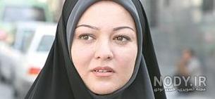 رزیتا غفاری قبل و بعد از عمل زیبایی رزیتا غفاری قبل و بعد از عمل زیبایی