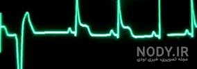 علت تپش قلب در آقایان