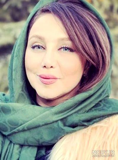 عکس بهنوش بختیاری بعد از عمل