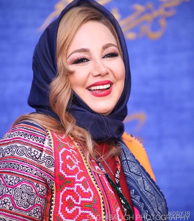 عکس بهنوش بختیاری قبل عمل بینی