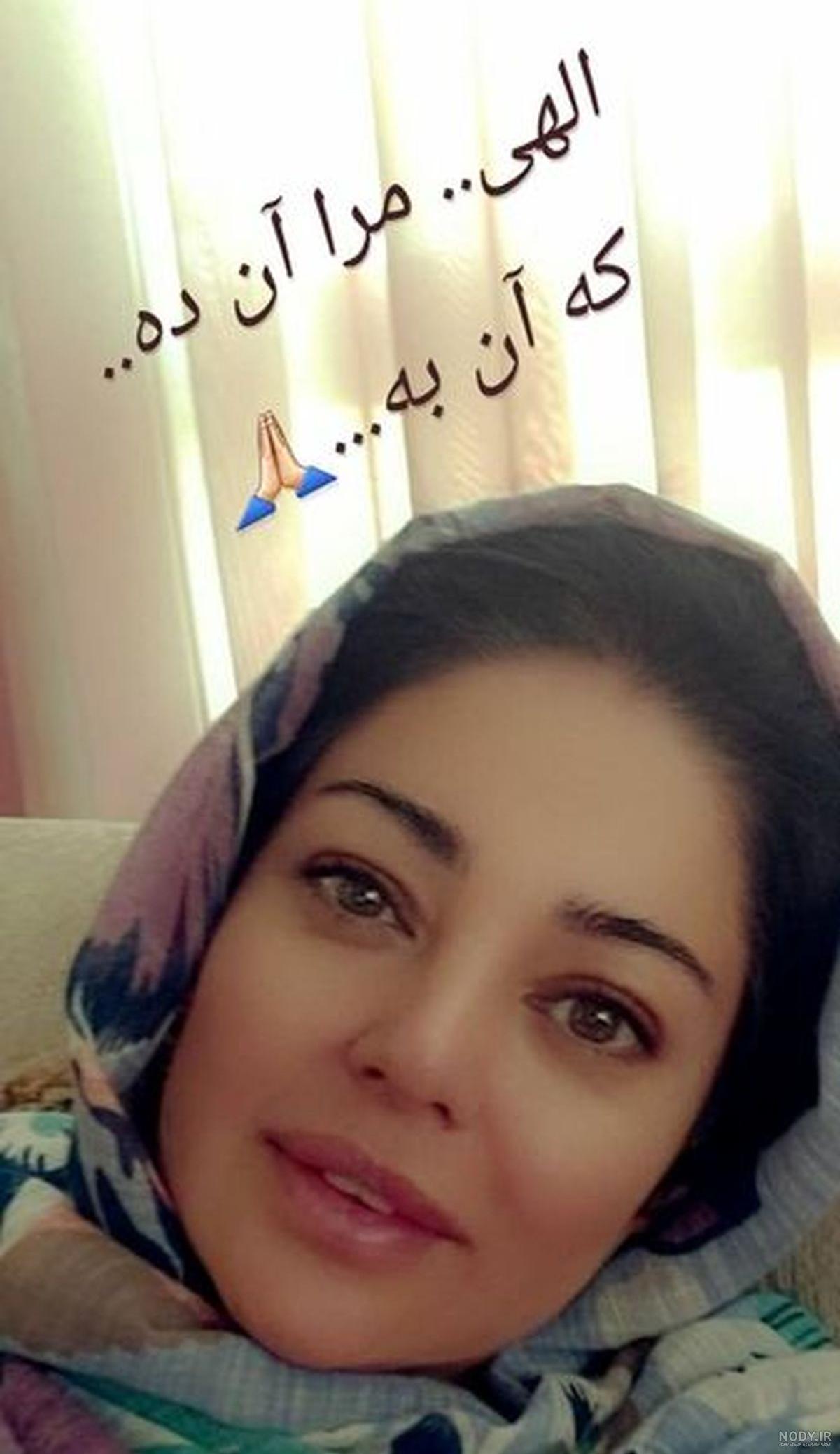 عکس قبل عمل رزیتا غفاری عکس قبل عمل رزیتا غفاری