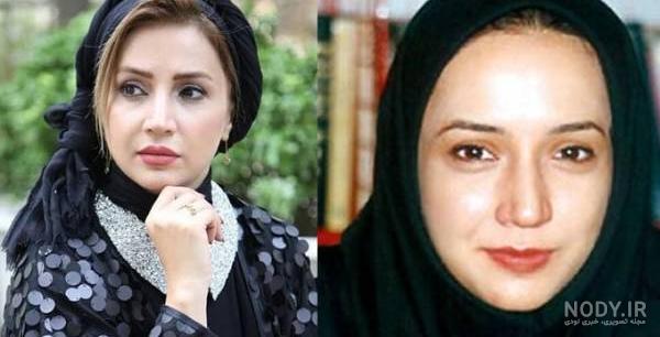 قیافه طناز طباطبایی قبل از عمل قیافه طناز طباطبایی قبل از عمل