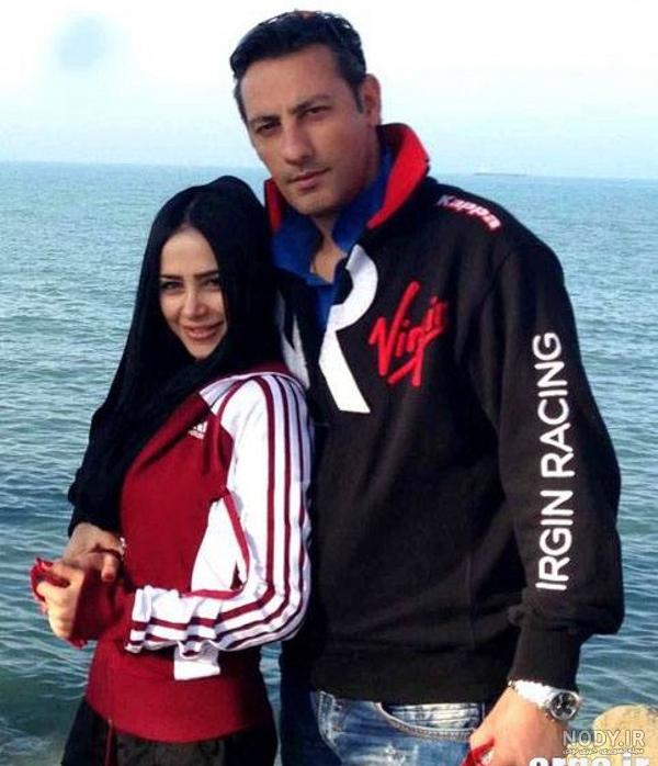 الناز حبیبی قبل از عمل الناز حبیبی قبل از عمل