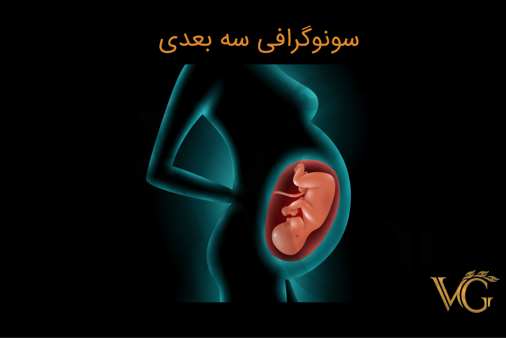 سونوگرافی سه بعدی برای چیست