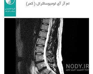 عکس ام ارای سالم کمر