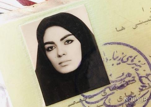 عکس سارا خوئینی ها قبل از عمل