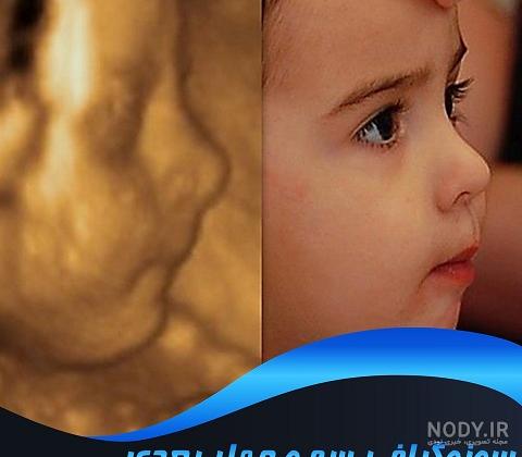 عکس سه بعدی جنین 18 هفته