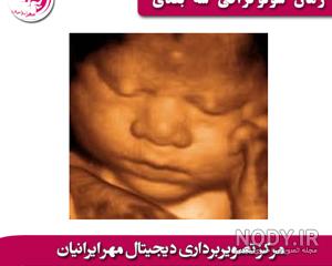 فیلم سونوگرافی جنین پسر