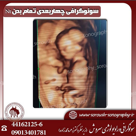 قیمت سونوگرافی سه بعدی