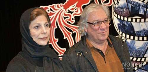 زهرا اویسی قبل از عمل زیبایی زهرا اویسی قبل از عمل زیبایی
