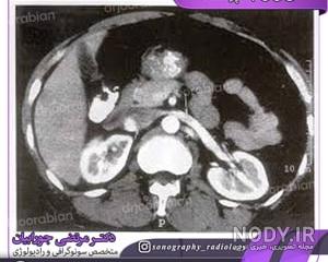 Vcug نی نی سایت
