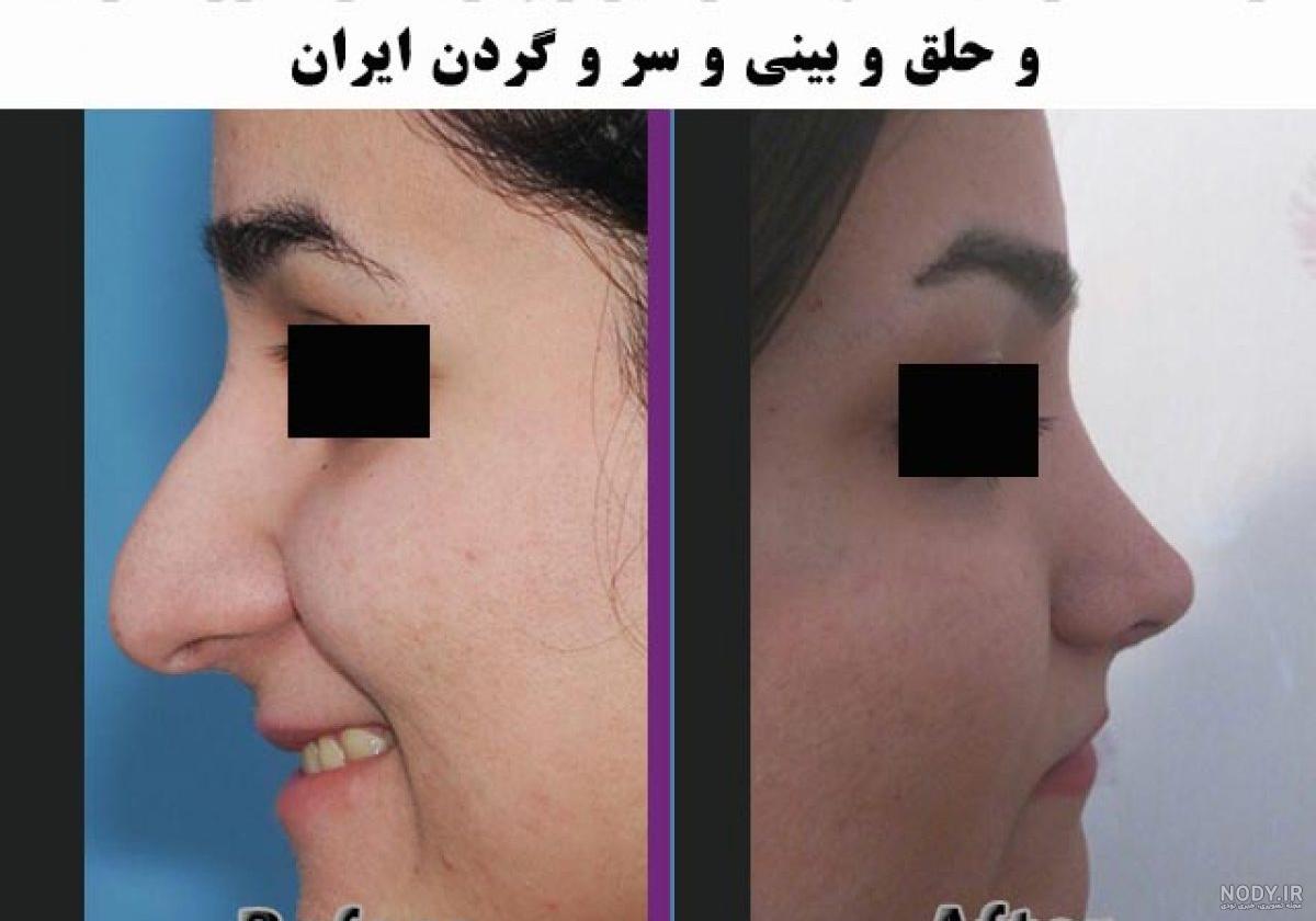 بهترین جراح بینی مردانه در تهران بهترین جراح بینی مردانه در تهران
