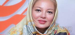 رزیتا غفاری قبل و بعد از عمل رزیتا غفاری قبل و بعد از عمل